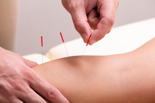 knee acupuncture