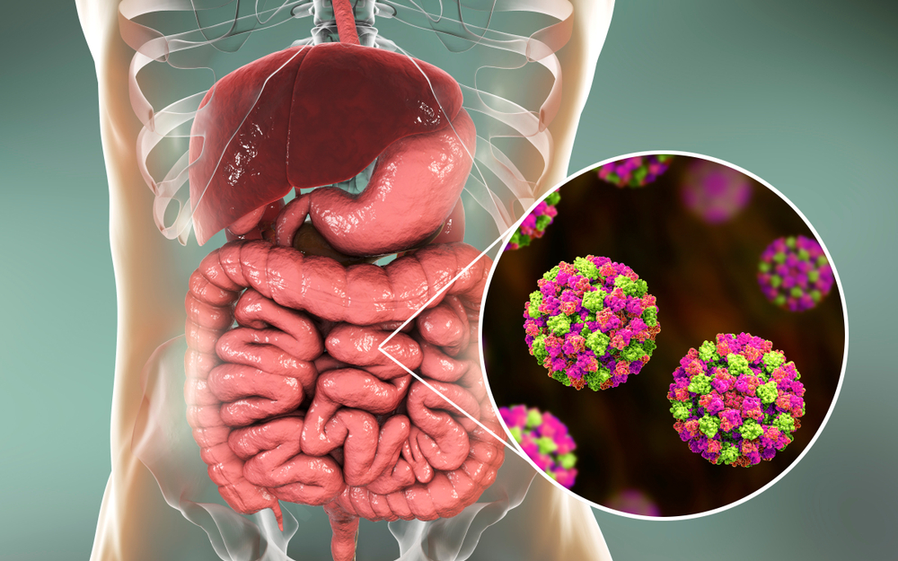 Norovirus,In,Human,Intestine,,Also,Called,Winter,Vomiting,Bug,,Rna